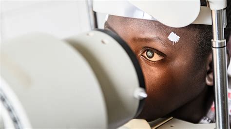 Cataracts In Children Causes Symptoms And Surgery Sightsavers