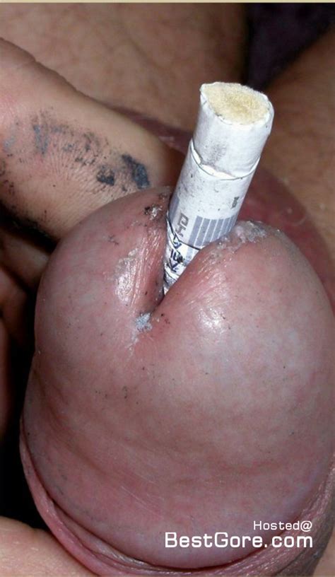 Close Up Of A Cigarette Sticking Out Of The Dick Hole