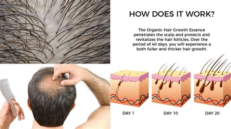 This Way You Can Regrowth Your Hair And Reduce Hair Fall Youtube