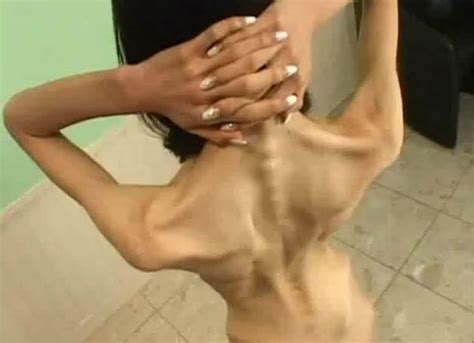 Anorexic Asian Nude Telegraph