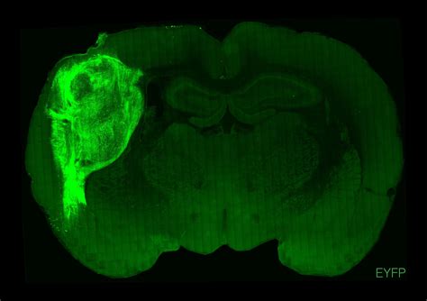 Human Brain Cells Grow In Rats And Feel What The Rats Feel The New