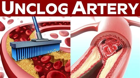 We did not find results for: 8 Best Foods That Unclog Arteries Naturally And Protect ...