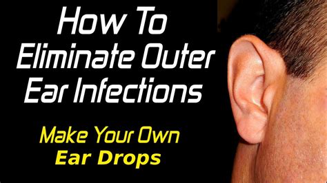 How To Treat Outer Ear Infections Youtube