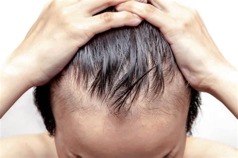 The Truth About Balding And What You Can Do About It Mailroom