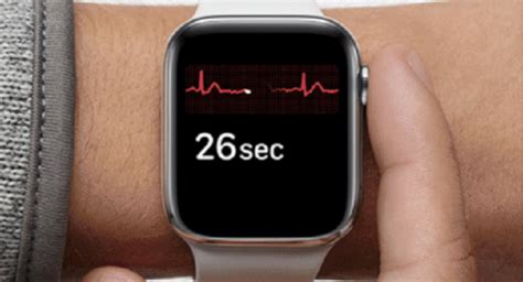 Apple said that during a clinical trial, the apple watch's ecg feature which is said to have similar capability as per a single lead ecg has 99.3 per. Apple Watch as an ECG? Feasible, May Prove Useful in ...