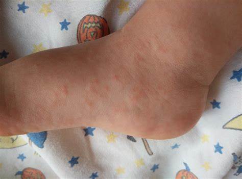 Можно на диете мед