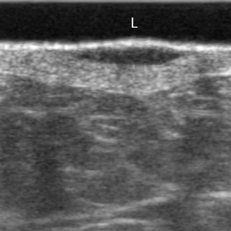 Pdf Automated Skin Lesion Classification On Ultrasound Images