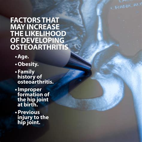Osteoarthritis Of The Hip Florida Orthopaedic Institute