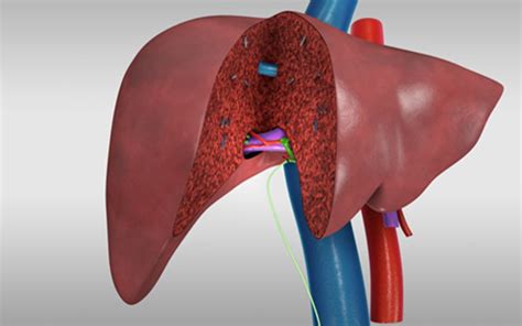 Liver Transplant Living Donor Right Lobe Recipient Procedure