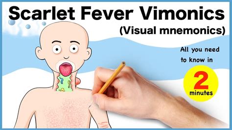Scarlet Fever Vimonics Visual Mnemonics Important Features Youtube