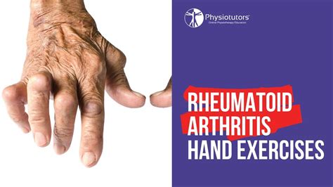 Rheumatoid Arthritis Hand Exercises Mobility And Strength Youtube