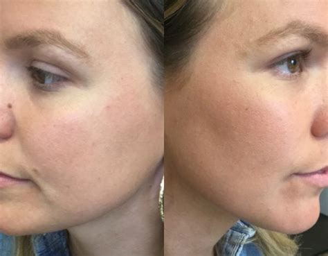 Makeup With Primer And Without
