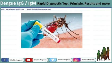 Dengue Igg Igm Rapid Diagnostic Test Principle Results And More