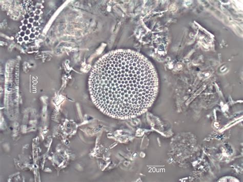 Diatomaceous Earth Celite 535 Under The Microscope