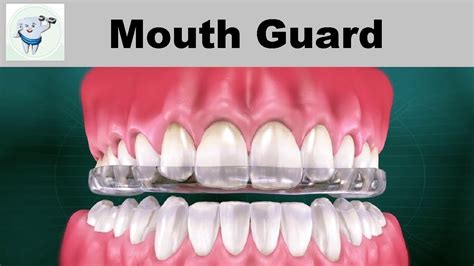 Grinding teeth in the middle of the night. Mouth Guard || Teeth Grinding in Sleep - YouTube