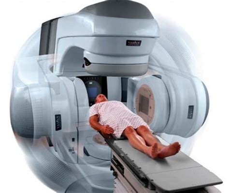 External Beam Radiation Therapy For Prostate Cancer The New Nation