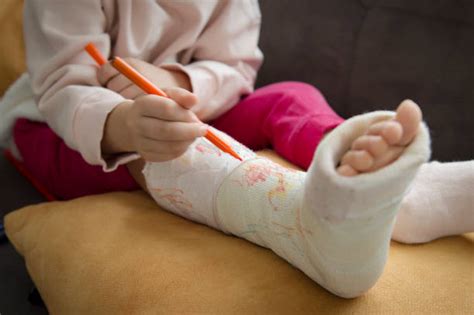 Child Leg Heel Fracture Or Broken Foot Bone Plaster Bandage Stock