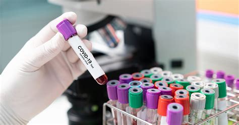 Antibody testing usually requires an appointment. Anvisa discute liberar testes rápidos para Covid-19 em farmácias