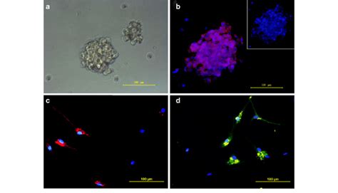 Primary Cultured Tumor Spheres And The Differentiation Of Gscs Bg3 A