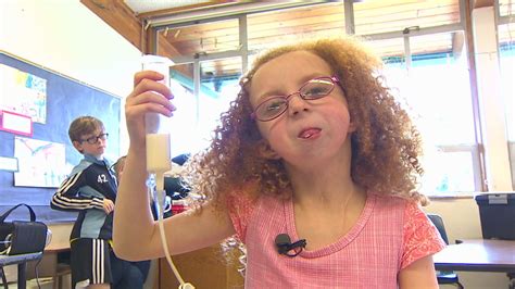 Girl With Rare Condition Born Without Jaw Katu