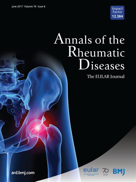 Low Immunogenicity Of Tocilizumab In Patients With Rheumatoid Arthritis