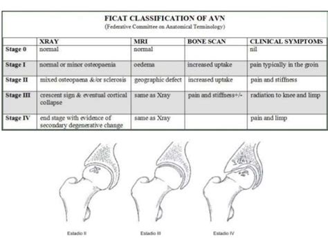 Ficat Classification For Avn Of The Femoral Head Classification