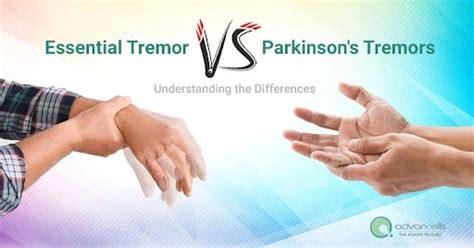 Essential Tremor Vs Parkinson S Disease Advancells