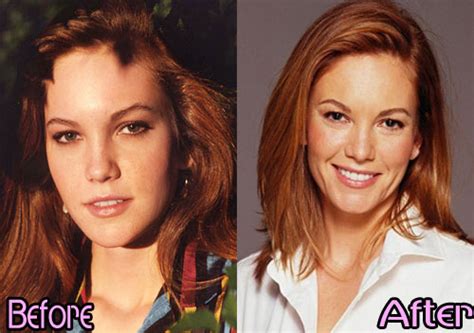 Diane Lane Plastic Surgery Before And After Photos