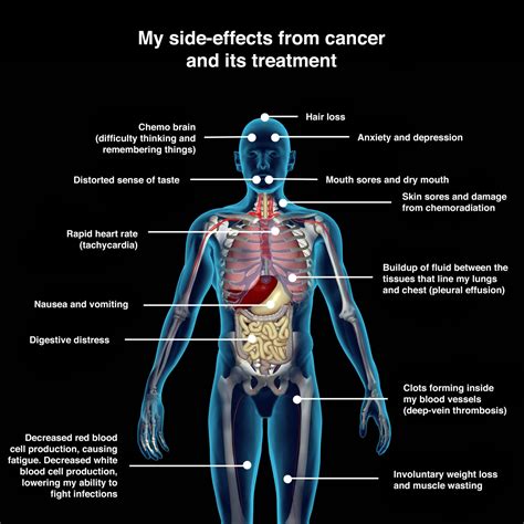 Hpv Vaccines Risks Pale In Comparison To The Cancer The Virus Can Cause