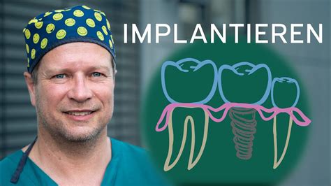 Klassisches Implantat In Der Oralchirurgie Youtube