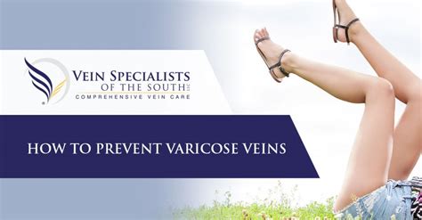 How To Prevent Varicose Veins Vein Specialists Of The South