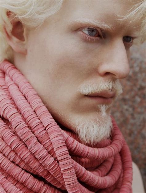 Pin By Mountainstare On Modern Characters Stephen Thompson Albino