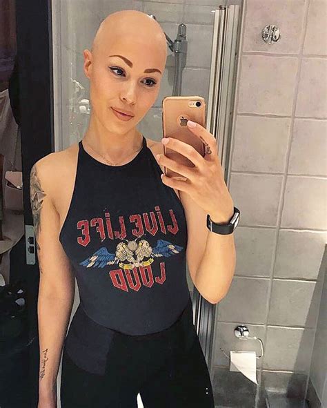 Nurse Proves Bald Is Beautiful As She Lands Dream Modelling Job After