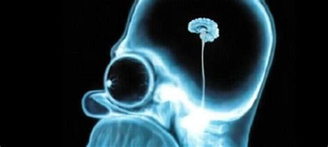 Nos visitó para tratarse de una rectificación cervical, en pocas sesiones recuperó su lordosis. Hémorragie cérébrale après 3 jours de jeu vidéo non-stop ...