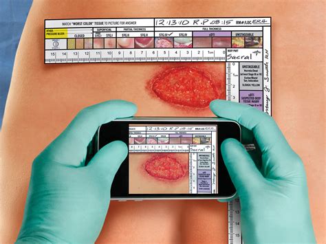 Wound Id Made Easy Using Evidence Based Nudges To Achieve