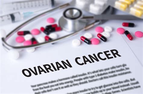 Treatment Approaches Evolving In Recurrent Ovarian Cancer Hysterectomy