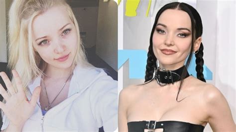 Dove Cameron S Plastic Surgery Reddit Discussions About The Actress