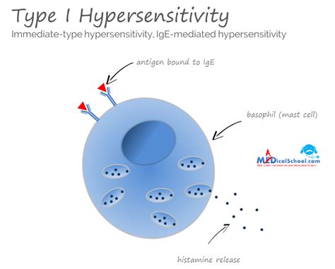 The Four Types Of Hypersensitivity