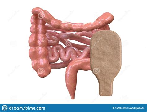 Colostomy Bag Connected With Intestine Isolated Over White