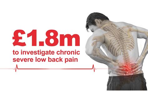 £18million Trial To Evaluate Treatment For Chronic Severe Low Back