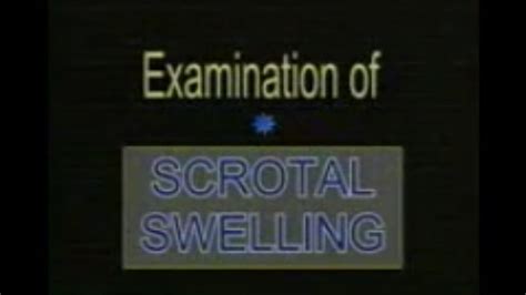 Examination Of Scrotal Swelling Clinical Examination In Surgery By Dr Ghanshyam Vaidya Youtube
