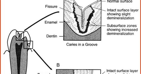 Dentistry Lectures For Mfdsmjdfnbdeore A Lecture Note On