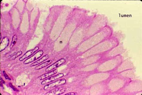 Goblet Cells In Stomach