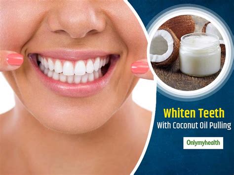 World Oral Health Day Benefits Of Coconut Oil Pulling For Oral Health OnlyMyHealth