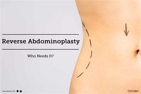 Abdominoplasty Pictures