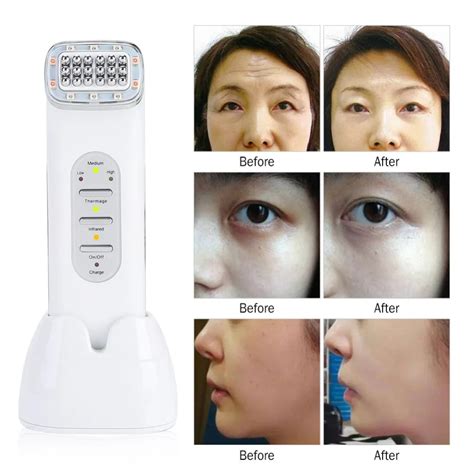 Eu Plug Rf Wrinkle Removal Beauty Machine Dot Matrix Facial Thermage