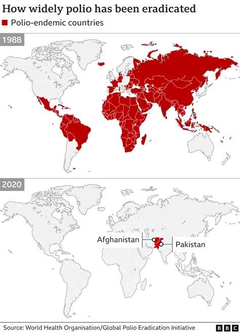 Polio Do We Have To Worry About It Once Again Bbc News