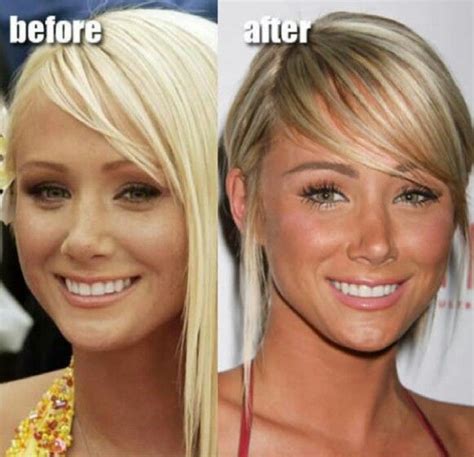 Before And After Plastic Surgery Sara Underwood Celebrity Plastic