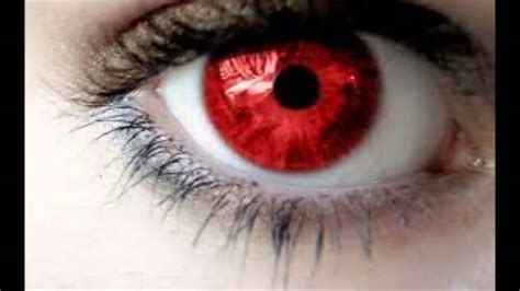 Albinos De Olhos Vermelhos