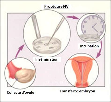 Fécondation in vitro FIV La Santé des Femmes et Style de Vie